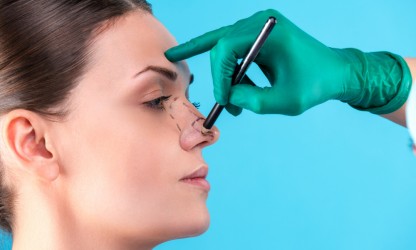 Rhinoplasty