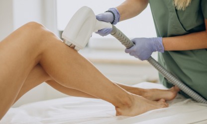 Laser Epilation