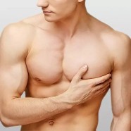 Gynecomastia