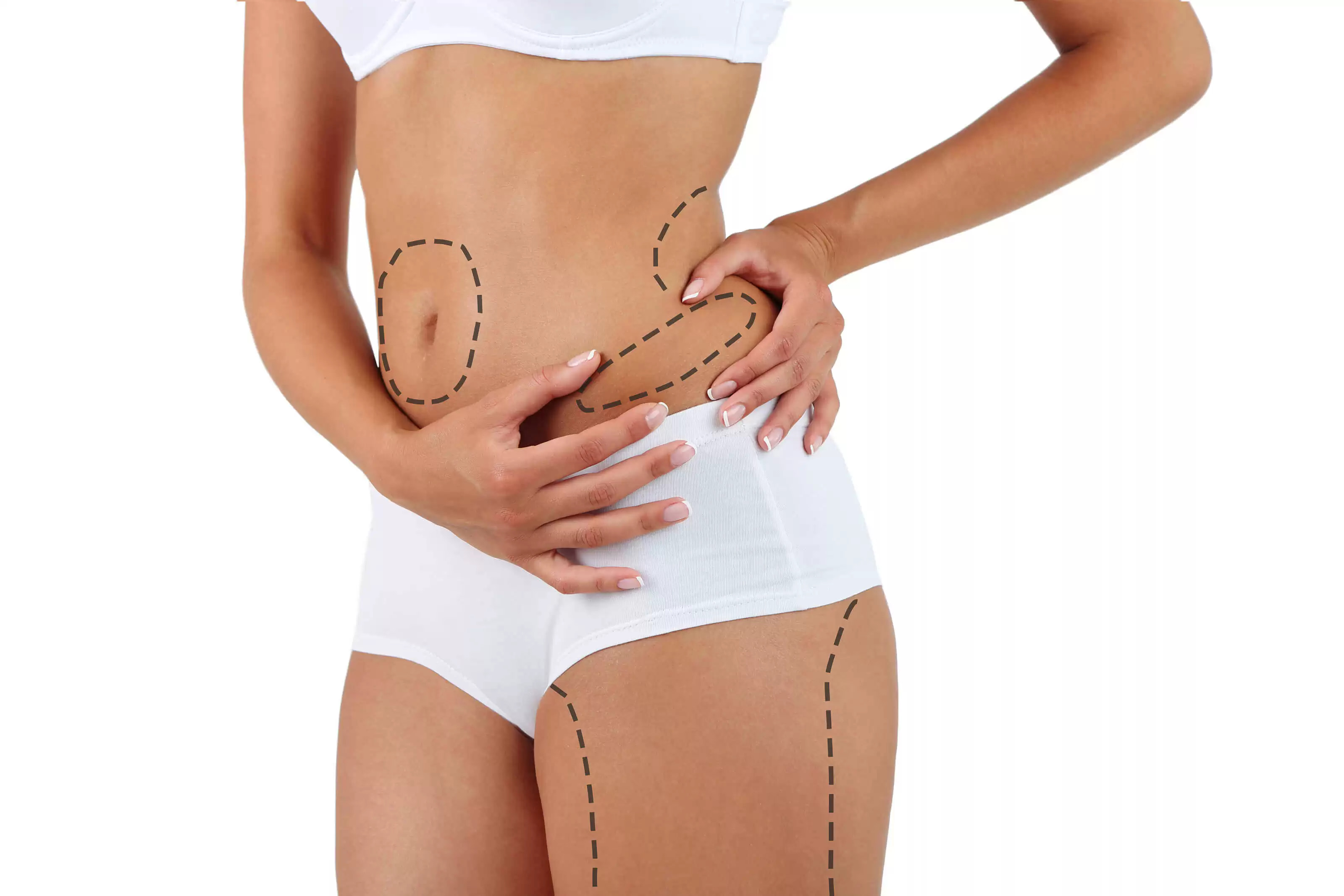 ankara liposuction tedavisi nasıl yapılır