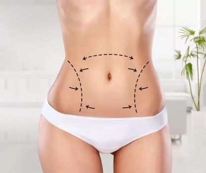 Liposuction İle Kaç Beden İncelebilirim?
