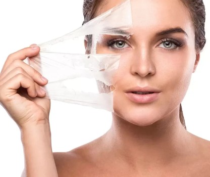 Ankara Kimyasal Peeling
