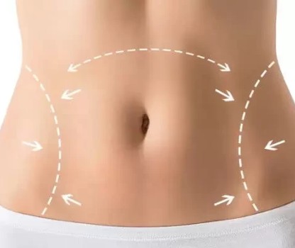 Liposuction Sonrası Şişlik Ne Zaman İner? Liposuction Sonrası Ödem Nasıl Atılır?