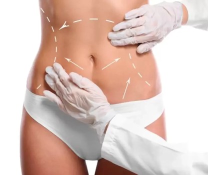 Liposuction ameliyatı için uygun bir aday mısınız? Hangi bölgelere uygulanır?