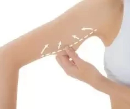 Liposuction Kimler Tarafından Yaptırılabilir?