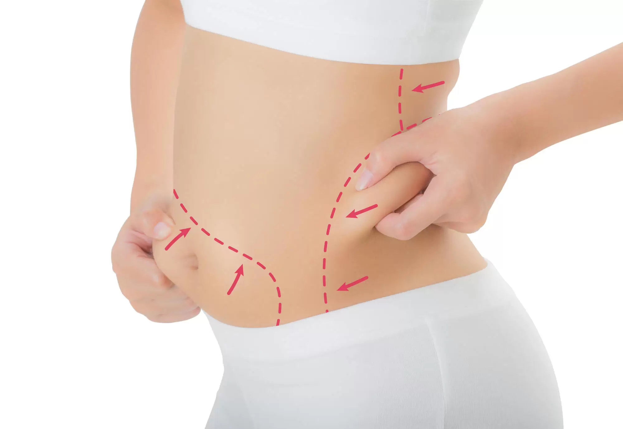 ankara liposuction dr serdar yüce