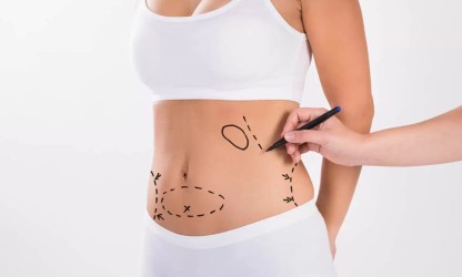 Ankara Liposuction